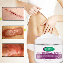 Scar Removal Cream